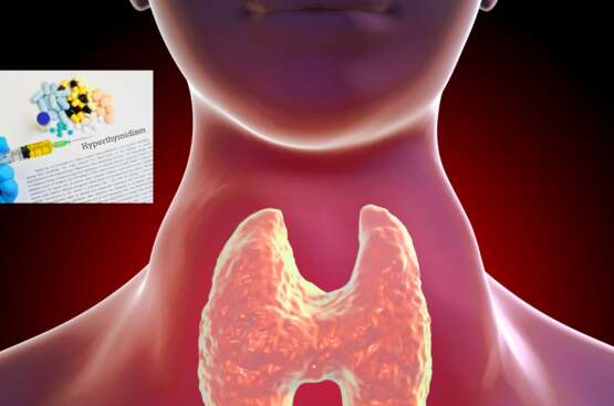 Hipertiroidismo: Conflictos Emocionales en Biodescodificación